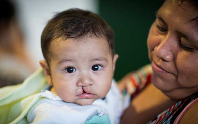 mercy outreach surgical team baby patient