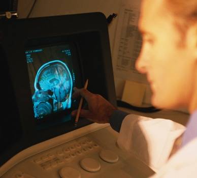 A neurologist reviews an image of a patient's on a monitor.